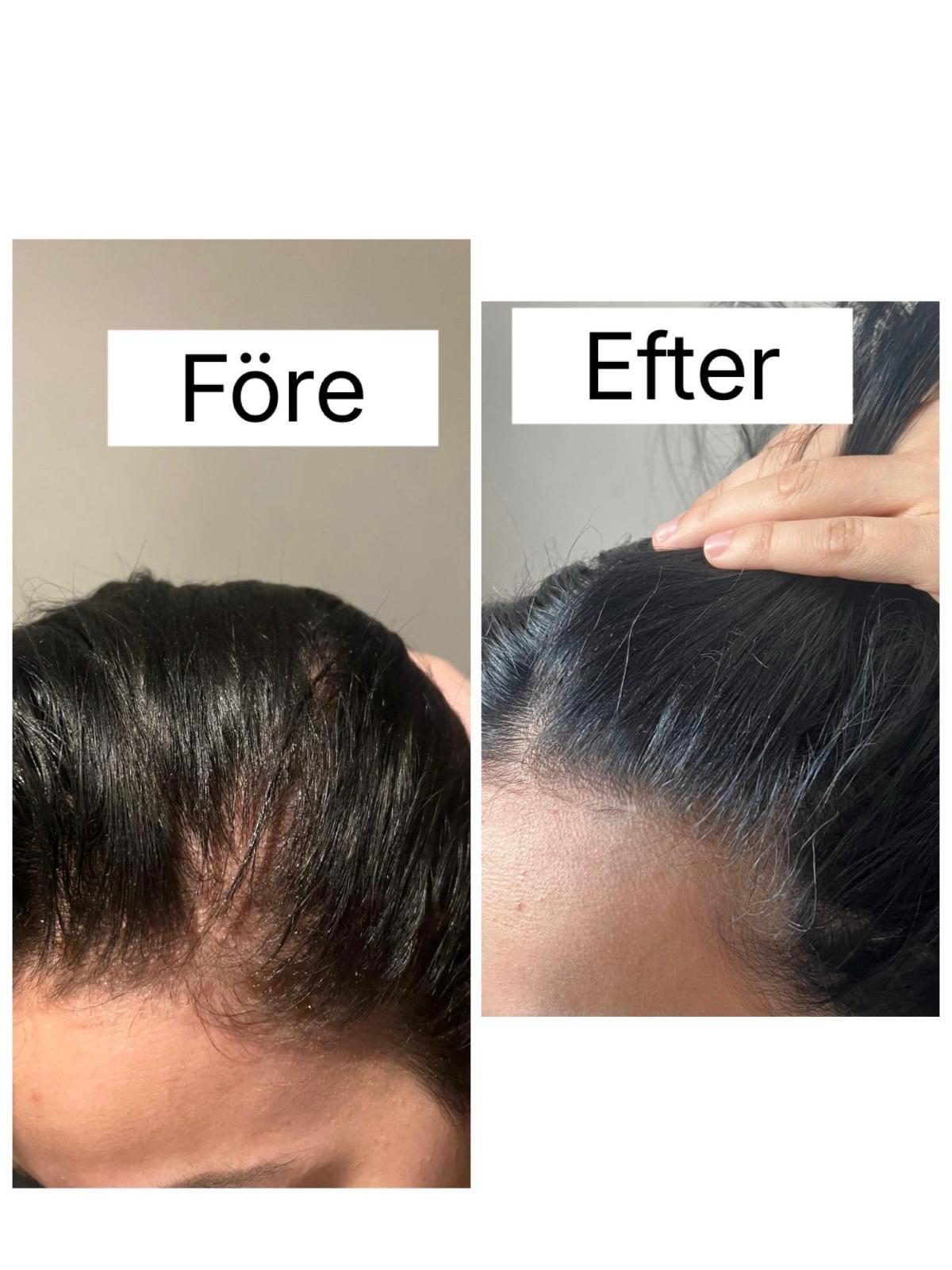 Before and After 2