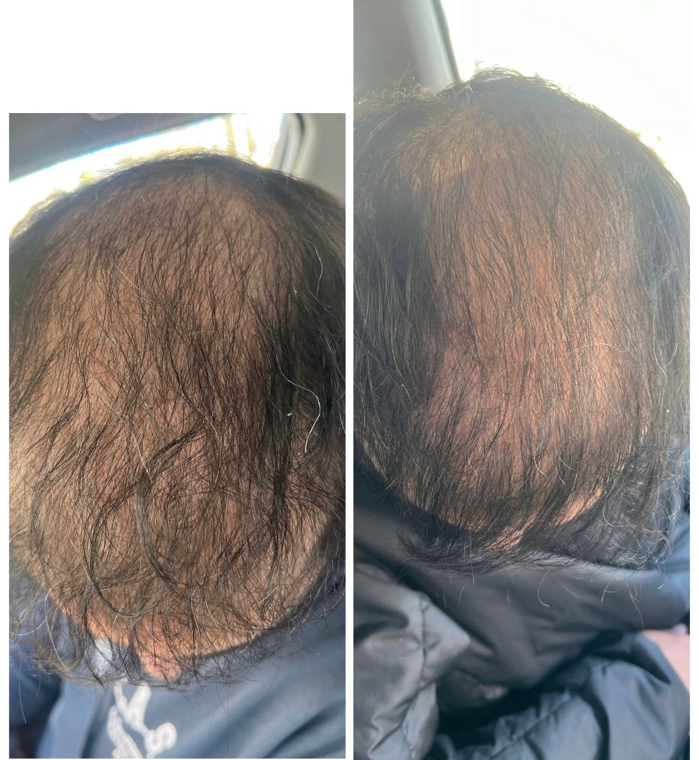 Before and After 4