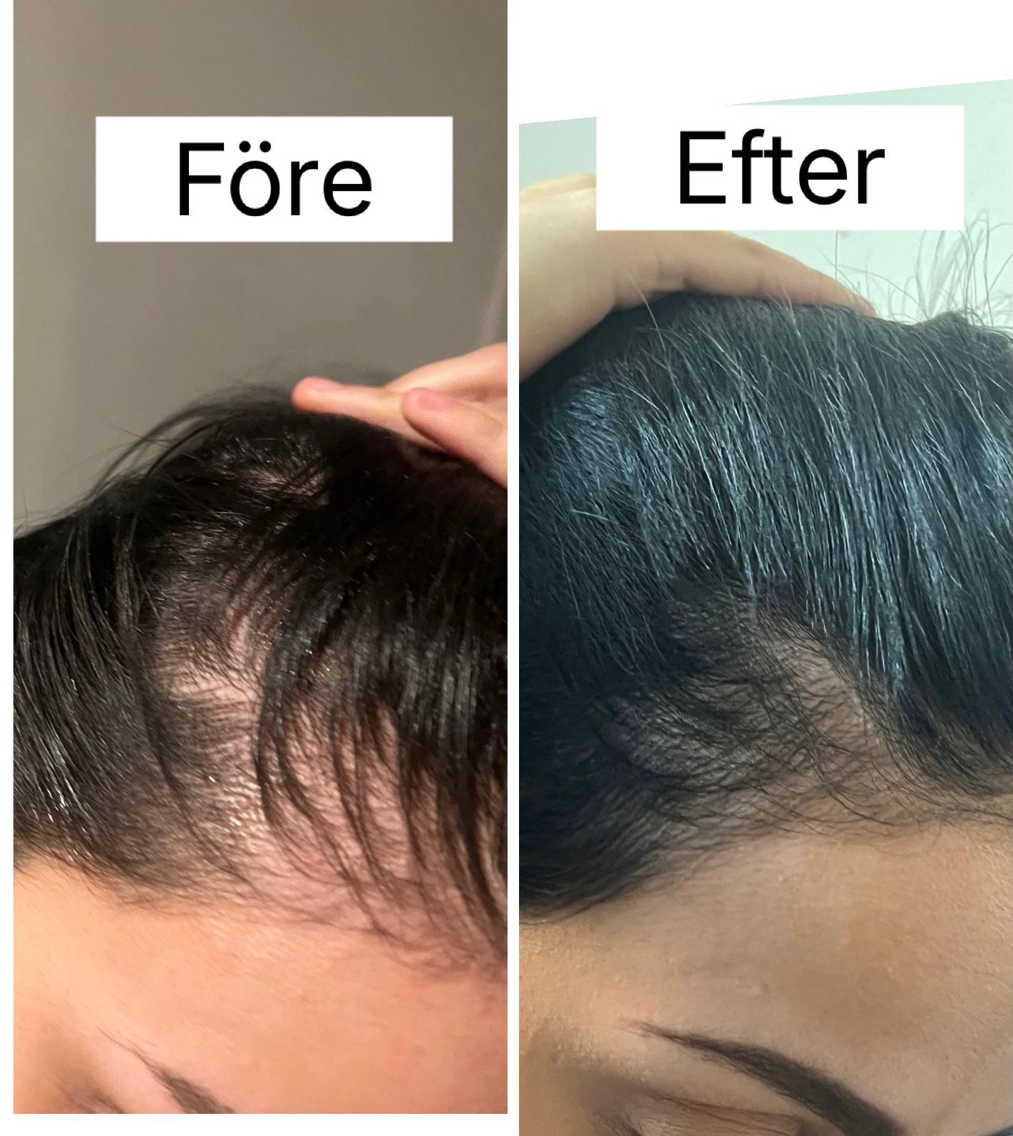 Before and After 5