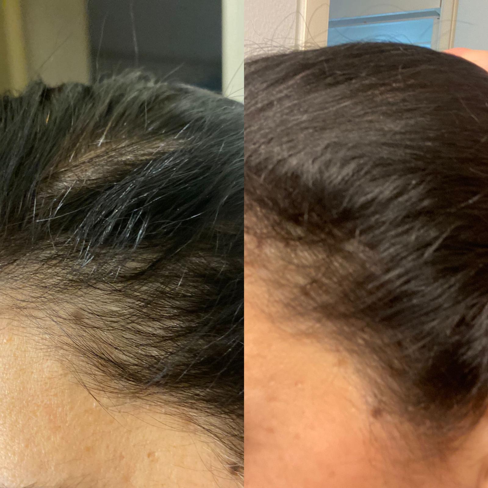 Additional Before and After Results