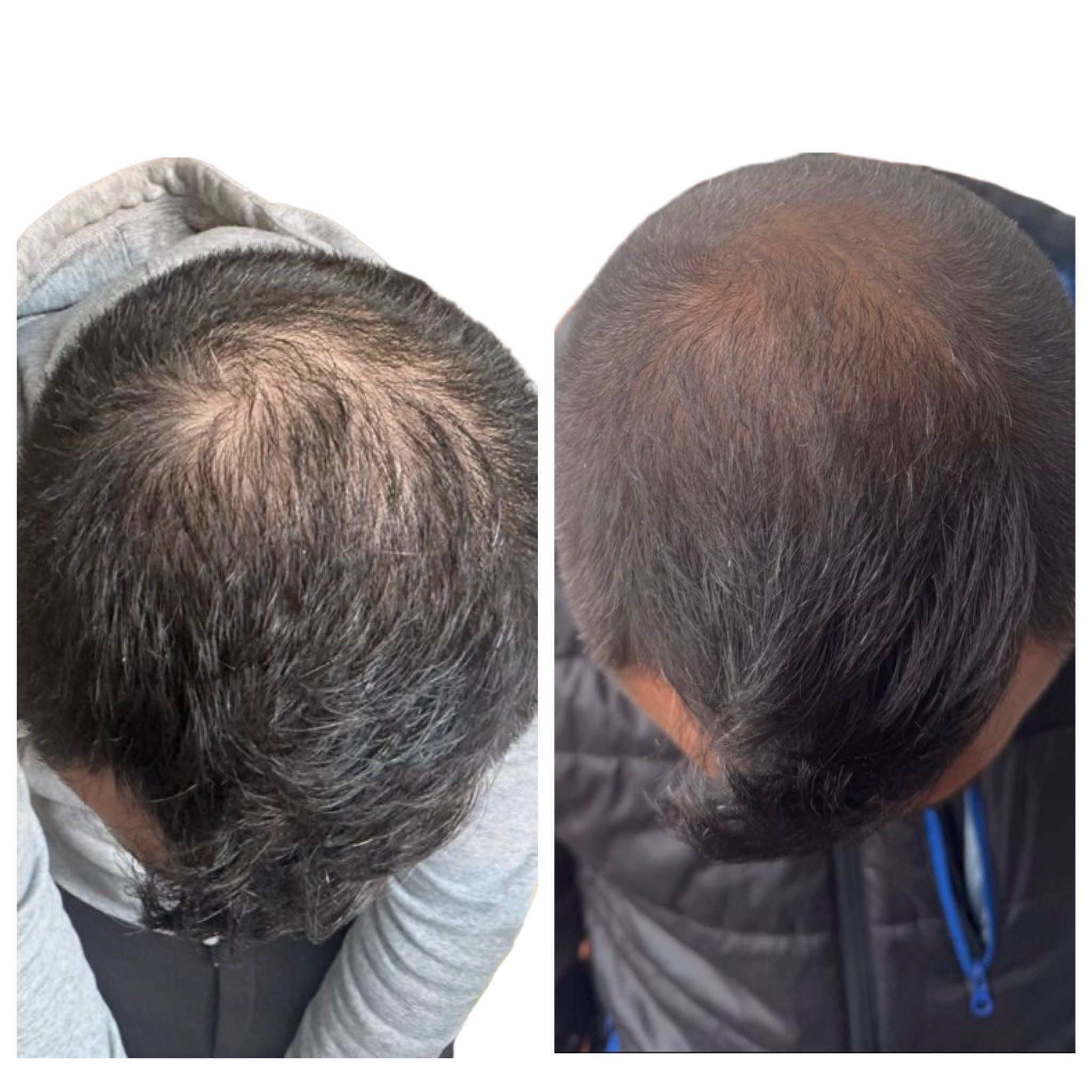 Before and After 1